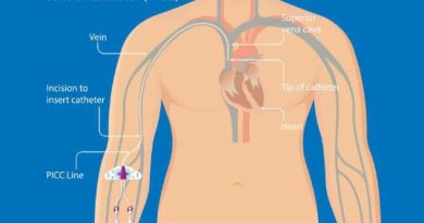 Catheter tĩnh mạch trung tâm đặt qua đường ngoại vi (PICC) – Giải pháp an toàn, hiệu quả cho bệnh nhân Lão khoa